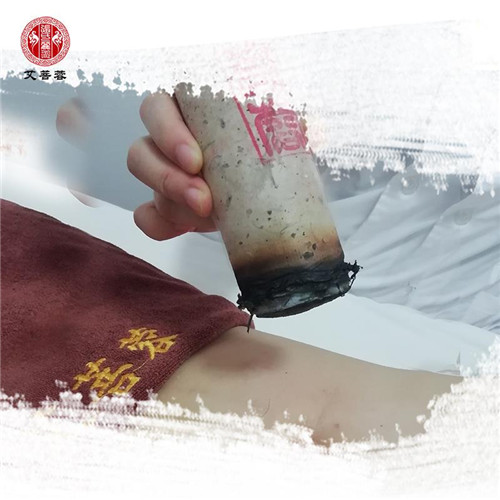 艾菩蓉艾灸